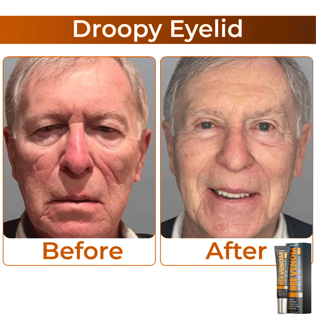 🎩 flysmus™ Collagen+ Bee Venom Wake Up Eye Cream for MEN 🇺🇸 Dermatologist Recommended